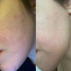 Transformative Results: Before and After Using Multi-Purpose Luxury Face Oil